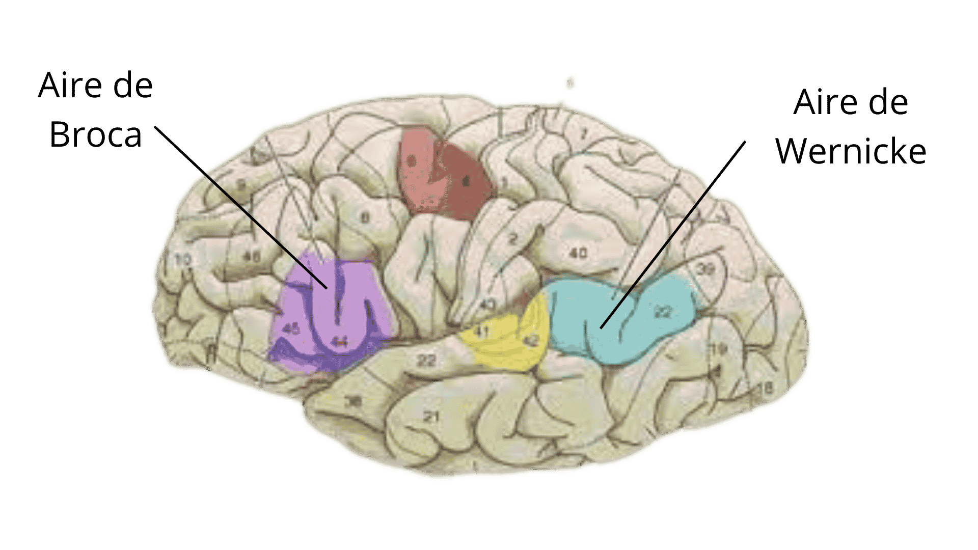 aphasia avc o que fazer após a reeducação avc