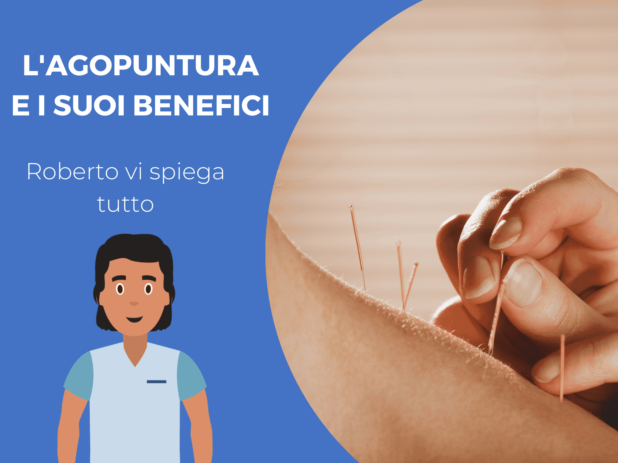 L’agopuntura e i suoi benefici