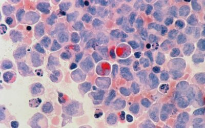 L’impact du cancer sur les fonctions cognitives : ce que vous devez savoir
