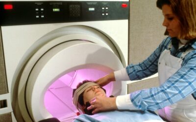 Avancées dans le traitement des troubles cognitifs post-cancer
