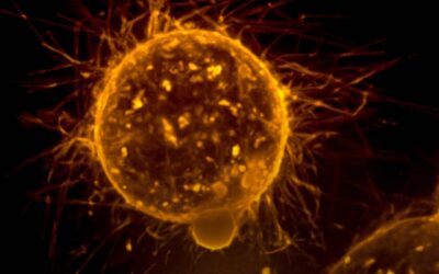 Comment le traitement du cancer de l’ovaire peut affecter la cognition : interventions et soutien